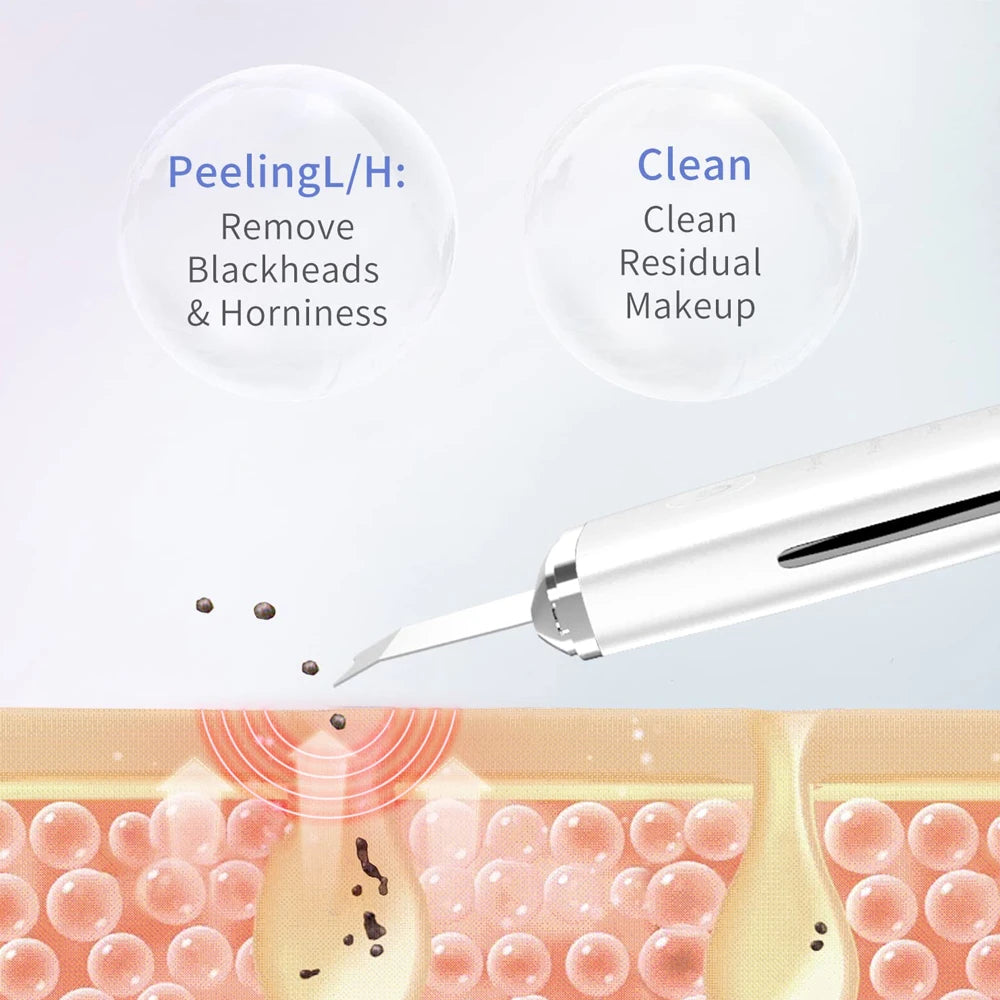 Ultrasonic Skin Scraper: Deep Clean & Blackhead Remover