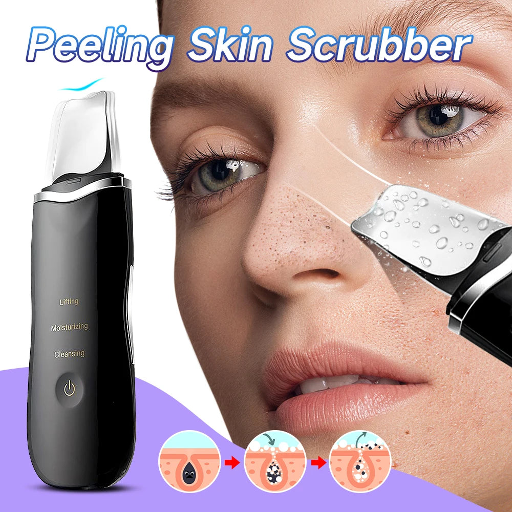 Ultrasonic Skin Scraper: Deep Clean & Blackhead Remover